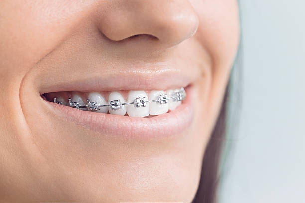 Best Dental Inlays and Onlays  in Cascade Locks, OR